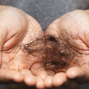 Cabelo Caindo Muito? Descubra as 5 Causas Mais Comuns (E Como Tratar)