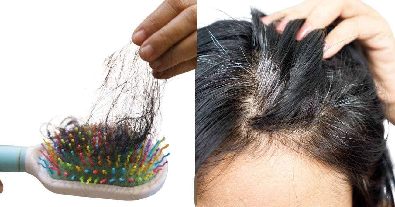 Cabelo Caindo e Branqueando?