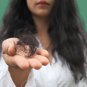 Seu Cabelo Está Caindo em Punhados? Descubra o Tratamento Que Funciona