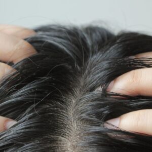 Coceira no Couro Cabeludo: Causas Comuns e Como Aliviar o Incômodo