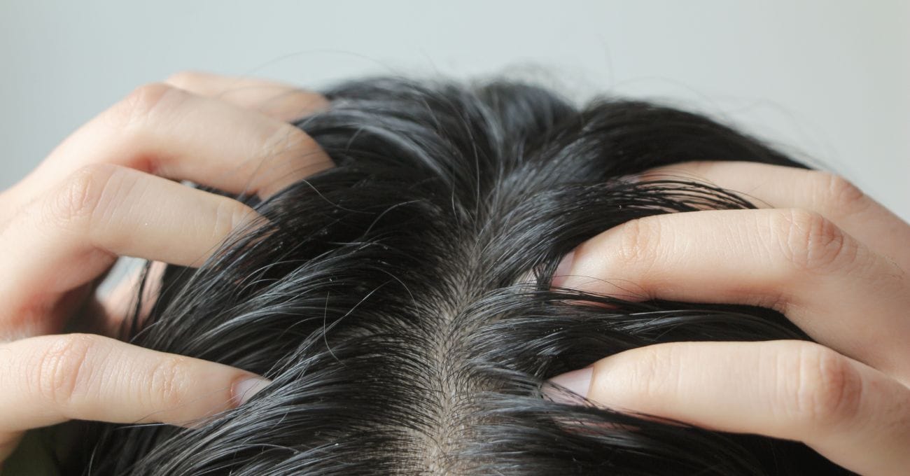 Coceira no Couro Cabeludo