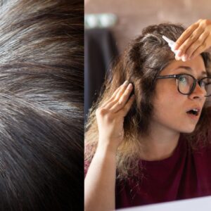 Fios Brancos Precoces: 7 Sinais de Deficiência Nutricional