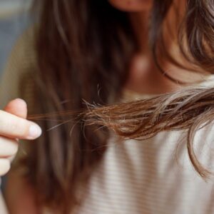 8 Situações em Que a Queda de Cabelo Deixa de Ser Algo Comum