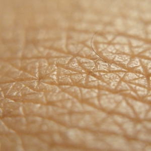 Peles Ressecadas: Causas, Tratamentos e Como Recuperar a Hidratação de Verdade